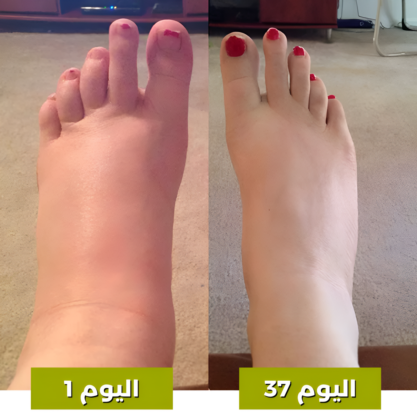 جهاز نورو™ 3 في 1 لتدليك الساقين - جهاز لتخفيف آلام الوذمة