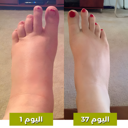 جهاز نورو™ 3 في 1 لتدليك الساقين - جهاز لتخفيف آلام الوذمة
